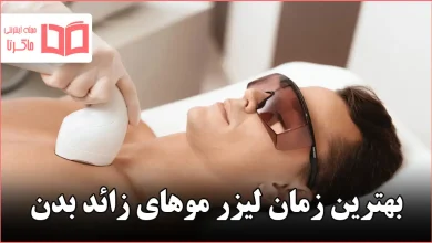 بهترین زمان لیزر موهای زائد بدن