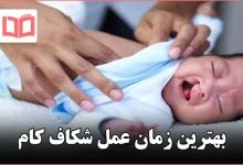 بهترین زمان عمل شکاف کام