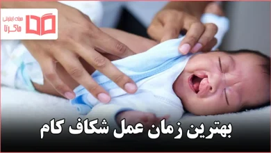 بهترین زمان عمل شکاف کام