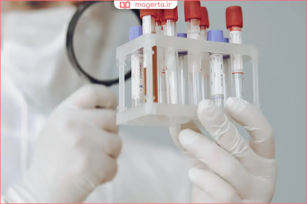 نمونه‌گیری خون برای آزمایش پرولاکتین در آزمایشگاه