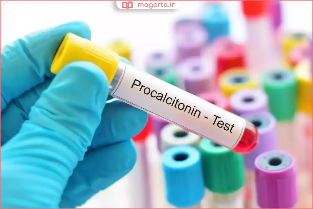 سرنگ و لوله آزمایش حاوی نمونه خون جهت سنجش پرولاکتین