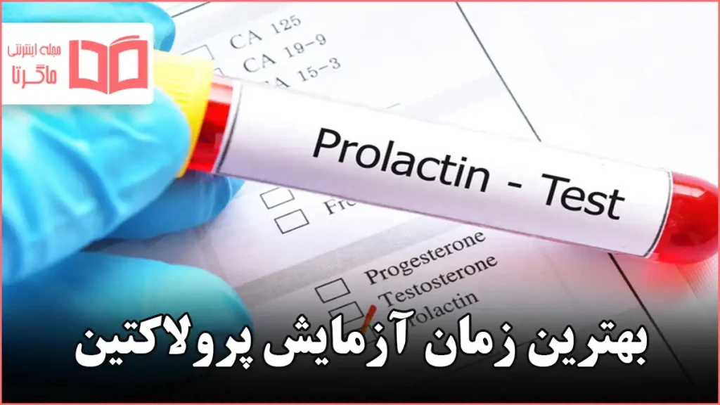 بهترین زمان آزمایش پرولاکتین