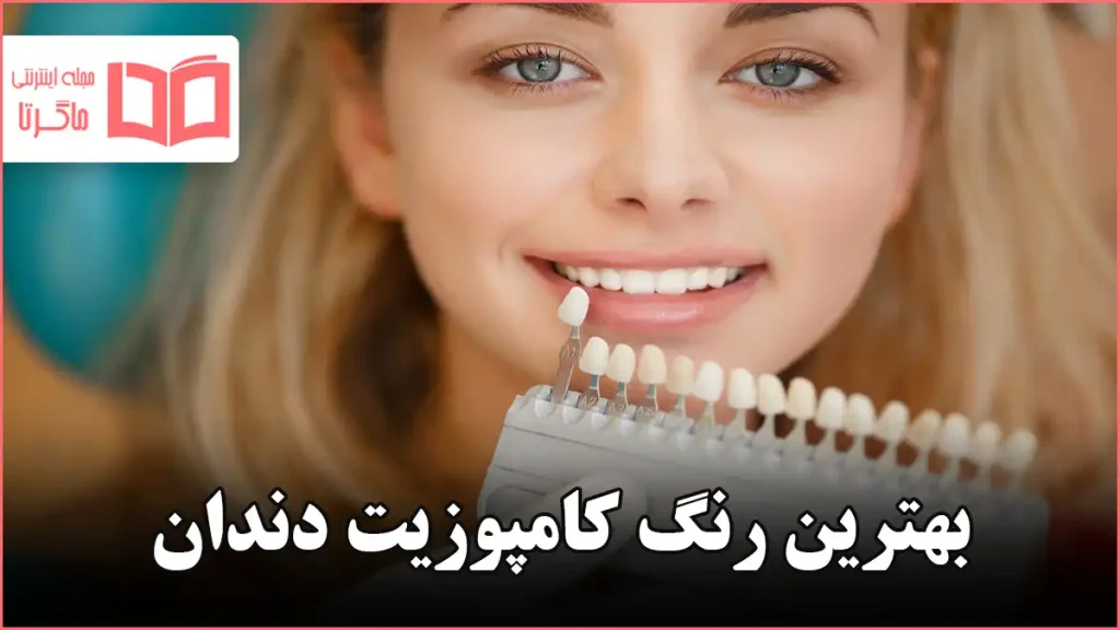 بهترین رنگ کامپوزیت دندان