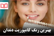 بهترین رنگ کامپوزیت دندان