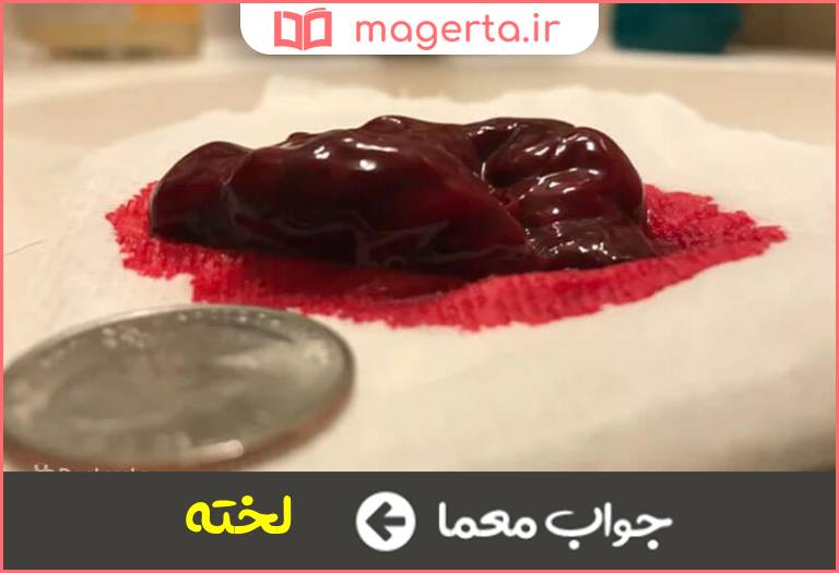 جواب معما خون بسته شده در جدول