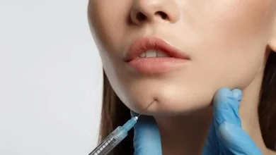 تزریق چربی به صورت چقدر ماندگاری دارد؟