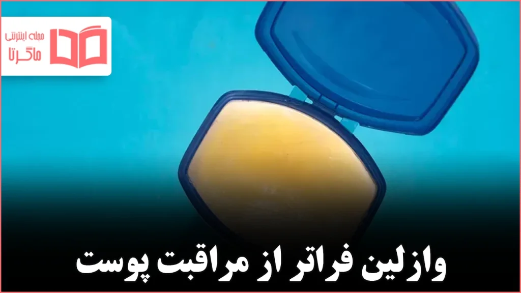 ۱۰ کاربرد شگفتانگیز و کاربردی وازلین فراتر از نرمکردن لبهای ترکخورده