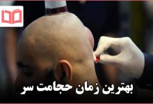 بهترین زمان حجامت سر