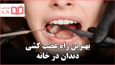 بهترین راه عصب کشی دندان در خانه