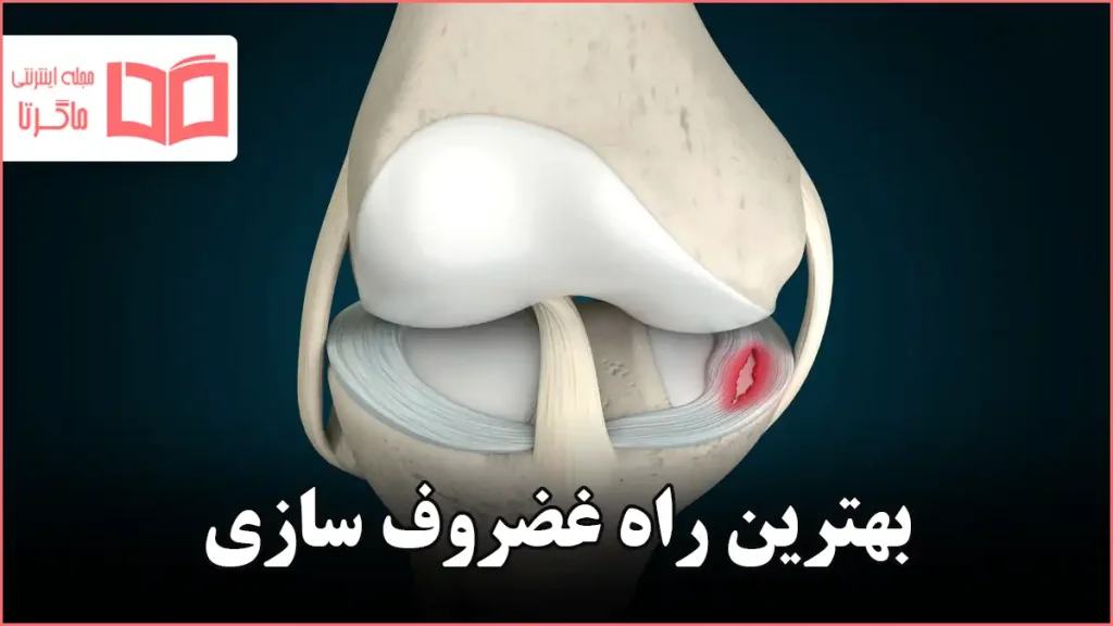 بهترین راه غضروف سازی