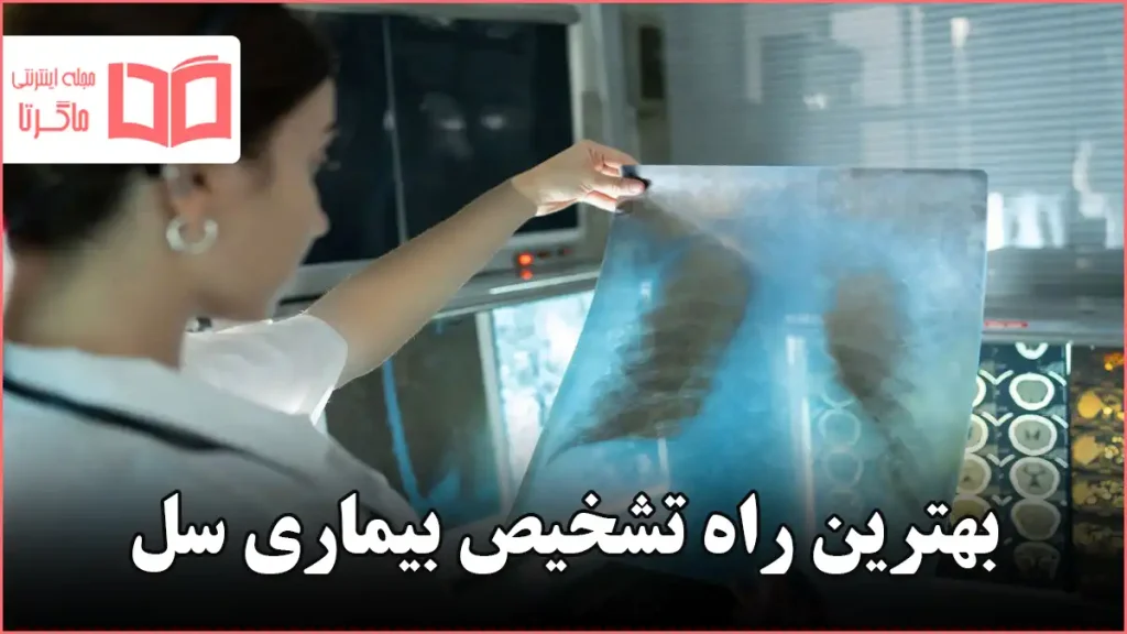 بهترین راه تشخیص بیماری سل
