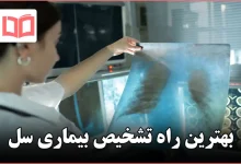 بهترین راه تشخیص بیماری سل