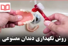 روش نگهداری دندان مصنوعی
