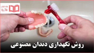 روش نگهداری دندان مصنوعی