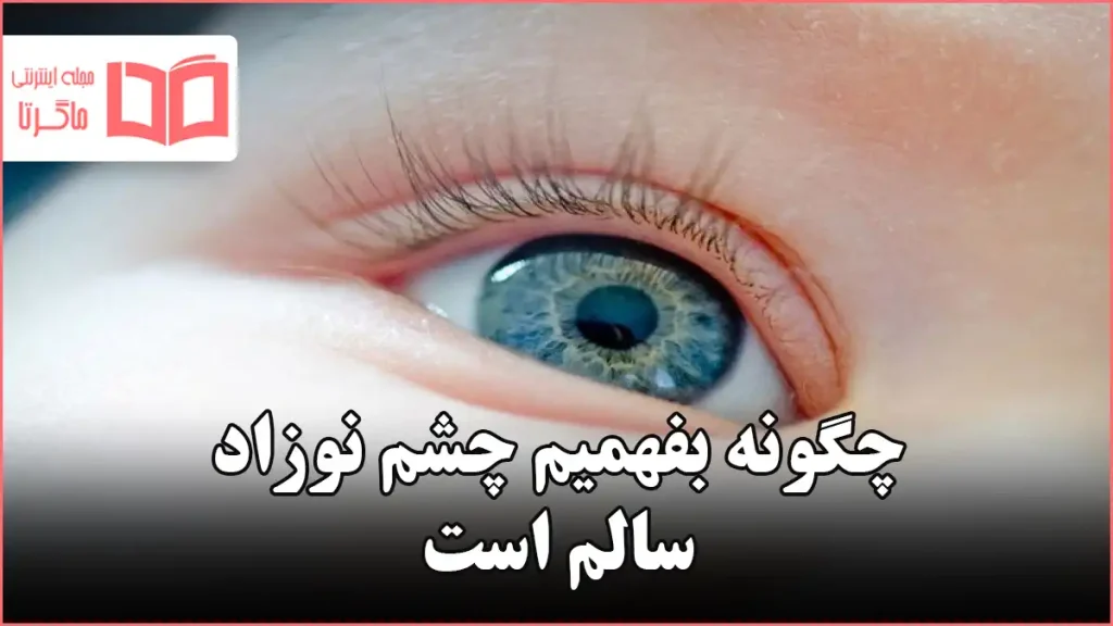 چگونه بفهمیم چشم نوزاد سالم است