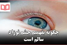 چگونه بفهمیم چشم نوزاد سالم است