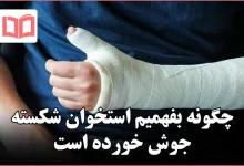 چگونه بفهمیم استخوان شکسته جوش خورده است