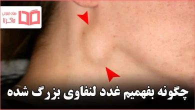 چگونه بفهمیم غدد لنفاوی بزرگ شده