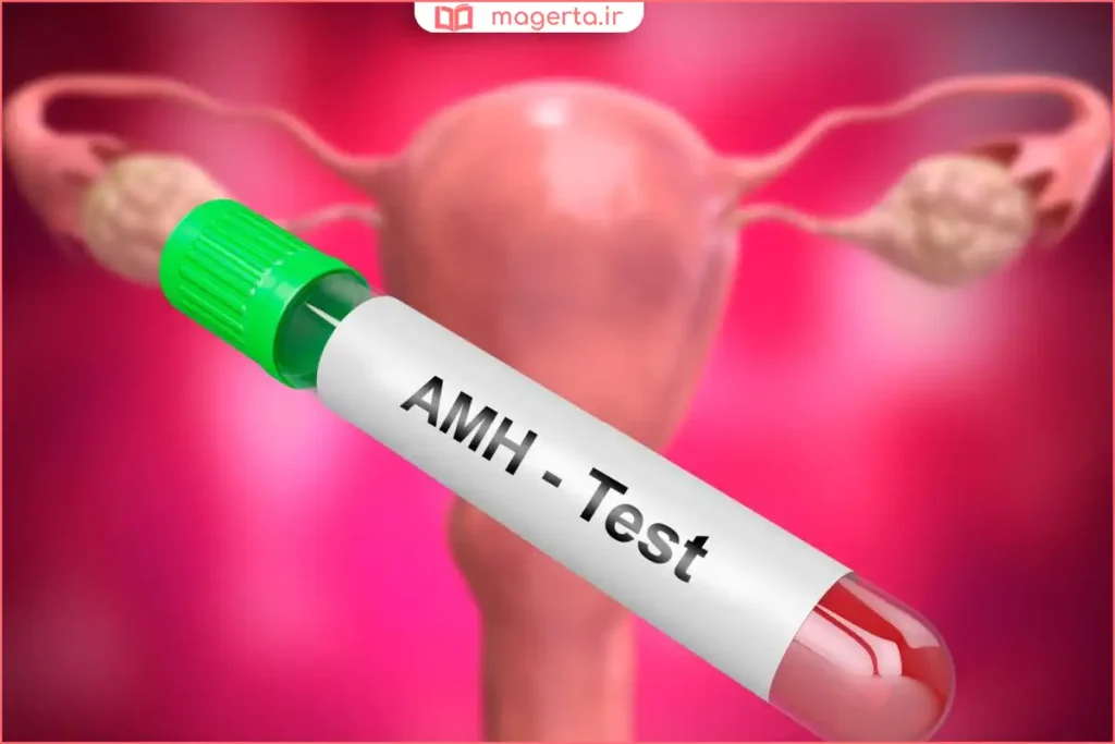 بررسی نتیجه آزمایش AMH در ارزیابی ذخیره تخمدان