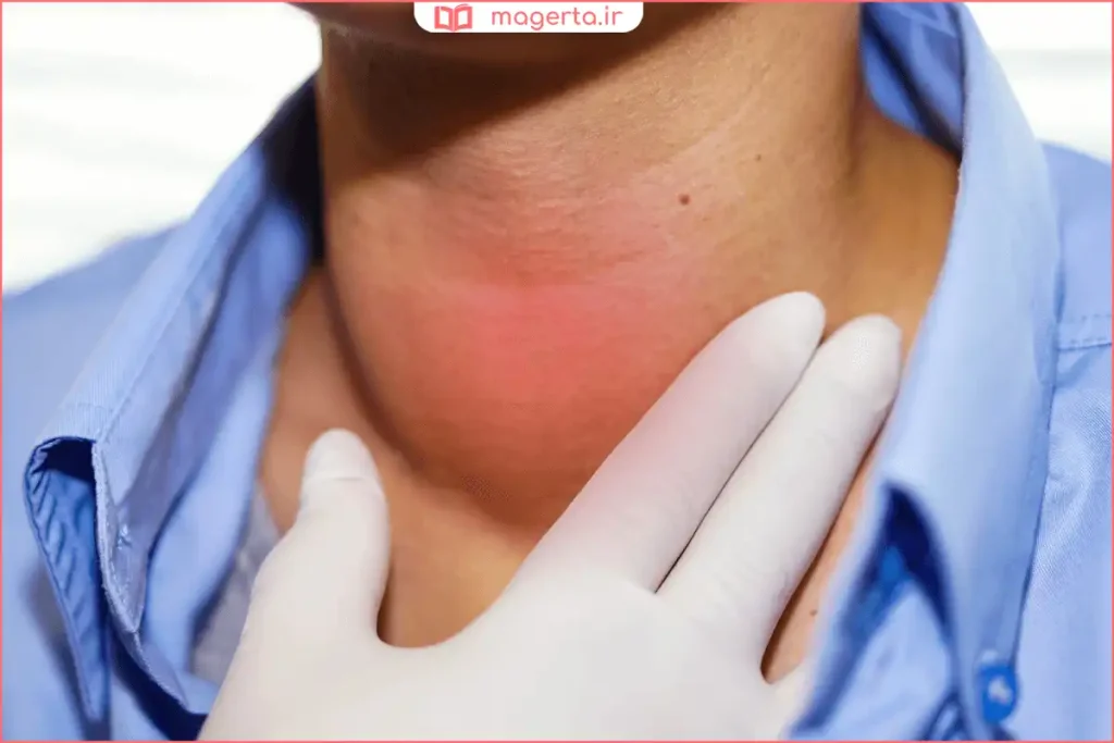 نمای شماتیک غده تیروئید و ارتباط آن با سیستم هورمونی