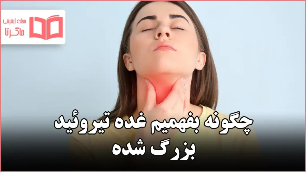 چگونه بفهمیم غده تیروئید بزرگ شده