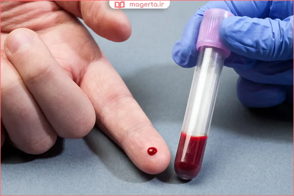 آزمایش خون با تمرکز بر هماتوکریت و هموگلوبین