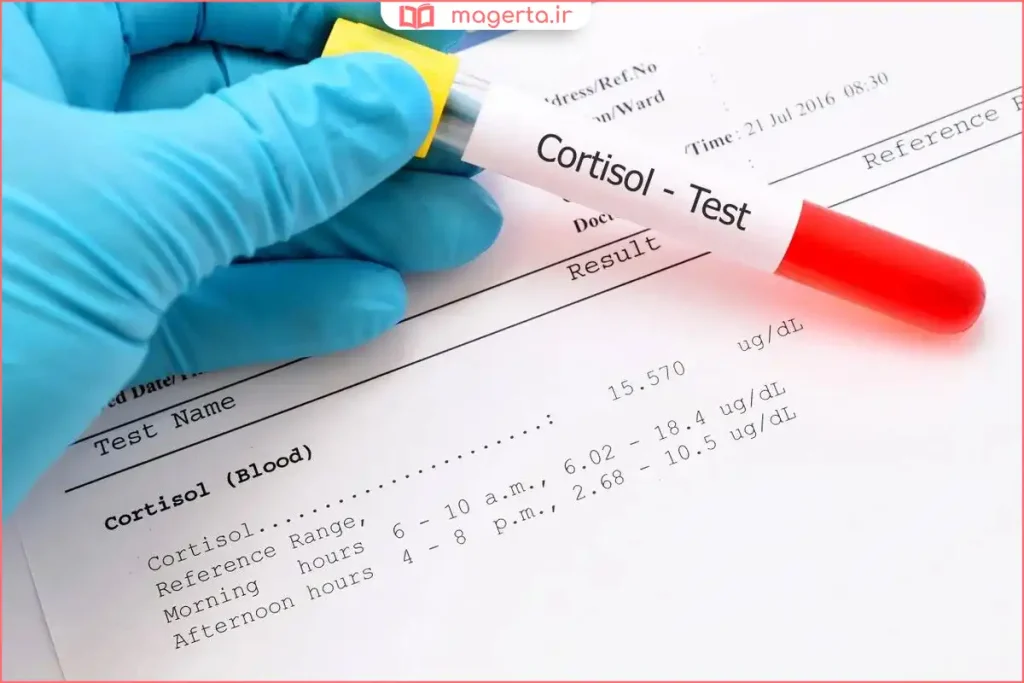 آزمایش خون هورمونی برای بررسی سطح کورتیزول