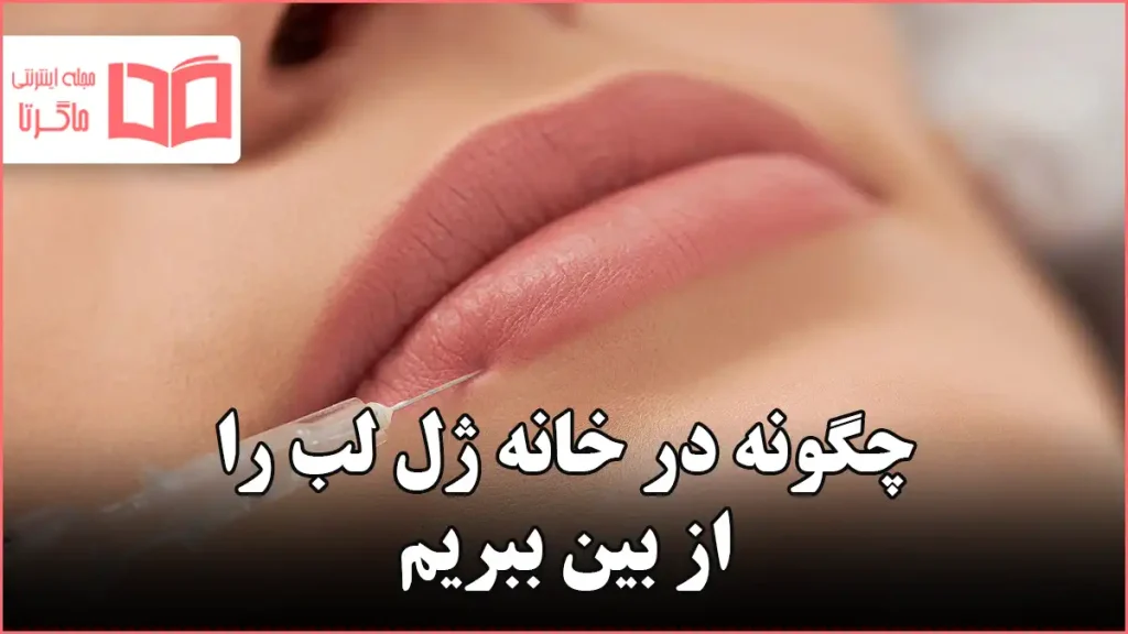 چگونه در خانه ژل لب را از بین ببریم