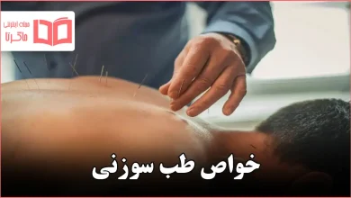 خواص طب سوزنی