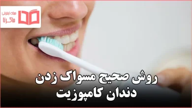 روش صحیح مسواک زدن دندان کامپوزیت