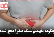 چگونه بفهمیم سنگ صفرا دفع شده