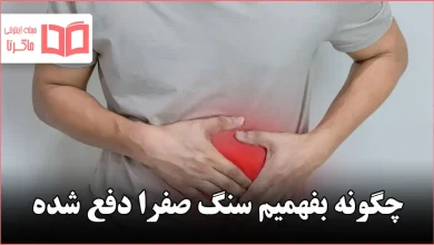 چگونه بفهمیم سنگ صفرا دفع شده