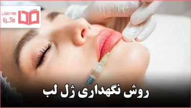 روش نگهداری ژل لب