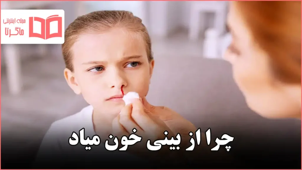 چرا از بینی خون میاد