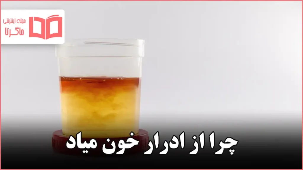 چرا از ادرار خون میاد