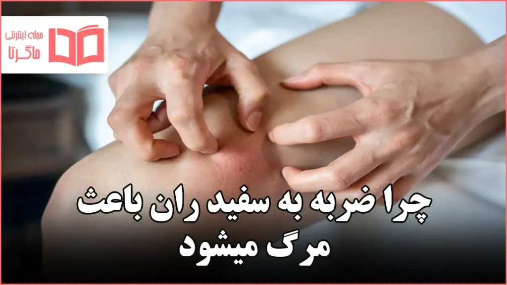 چرا ضربه به سفید ران باعث مرگ میشود