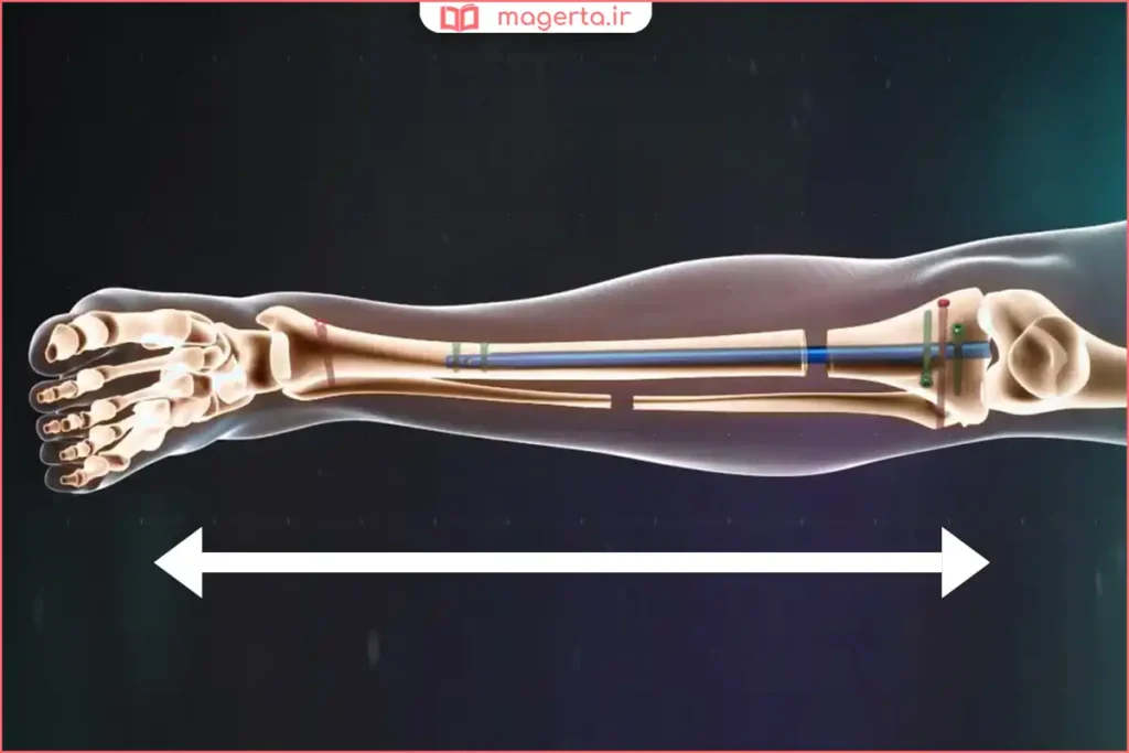 استفاده از پلاتین در تجهیزات پزشکی کاشتنی داخل بدن انسان
