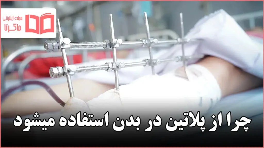 چرا از پلاتین در بدن استفاده میشود