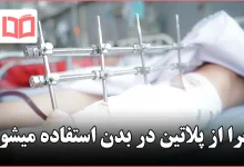 چرا از پلاتین در بدن استفاده میشود