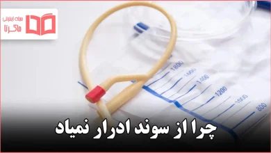 چرا از سوند ادرار نمیاد
