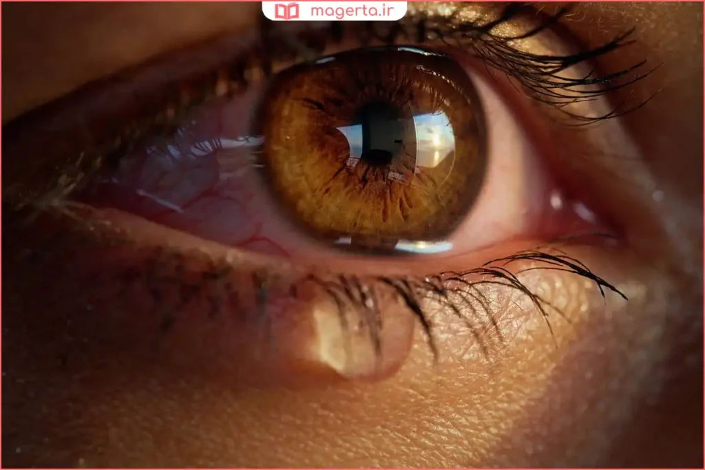 آبریزش چشم در اثر گرد و غبار یا باد