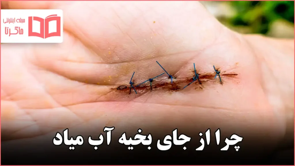 چرا از جای بخیه آب میاد