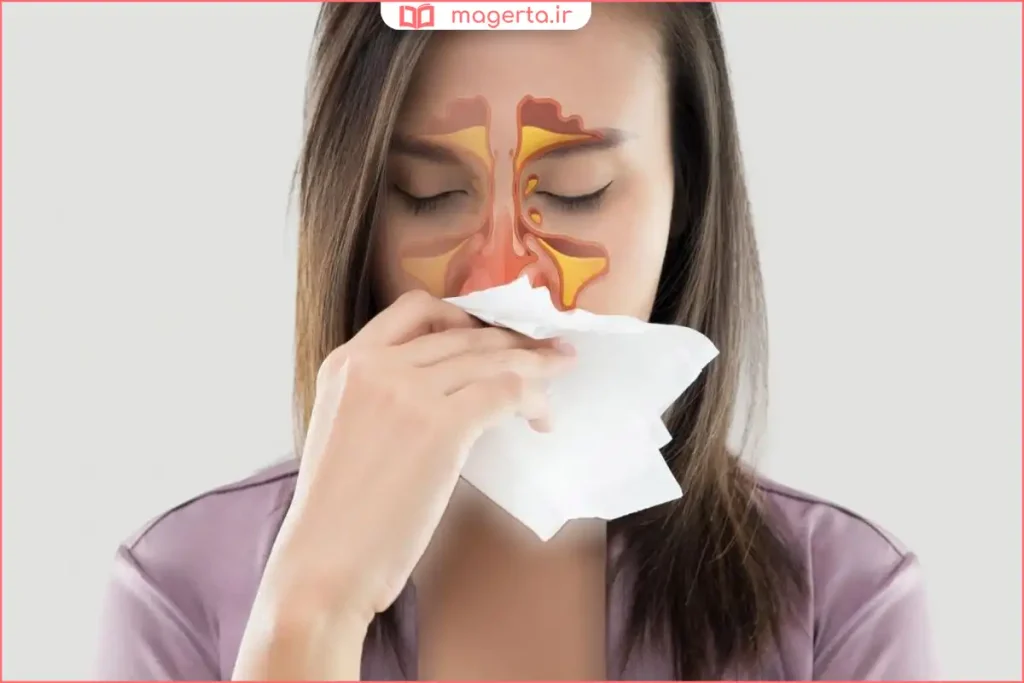 خروج ترشحات زرد رنگ از بینی در زمان سرماخوردگی