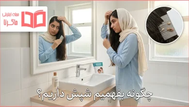 چگونه بفهمیم شپش داریم؟