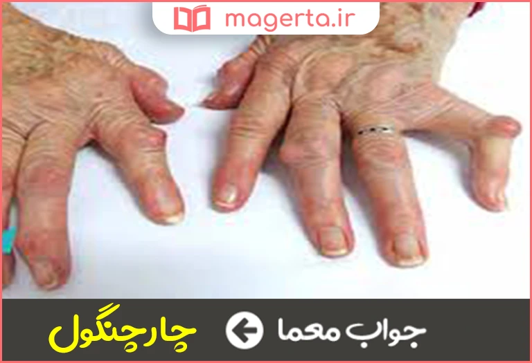جواب معما انکه دست وپایش جمع و خمیده شده در جدول