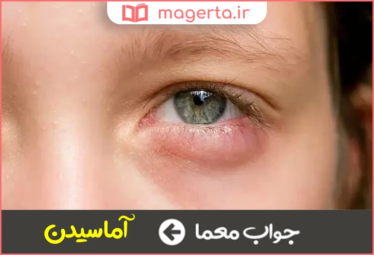 جواب معما ورم کردن در جدول