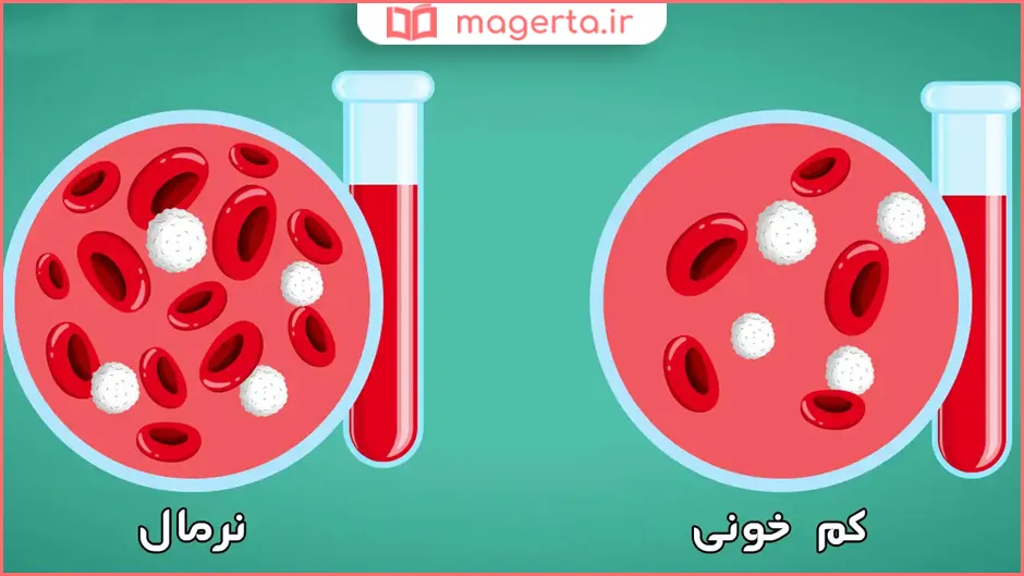 چه بخوریم تا کم خونی فوری درمان شود؟