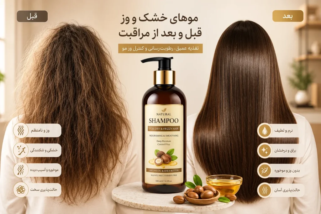 بهترین شامپوها برای موی خشک و وز