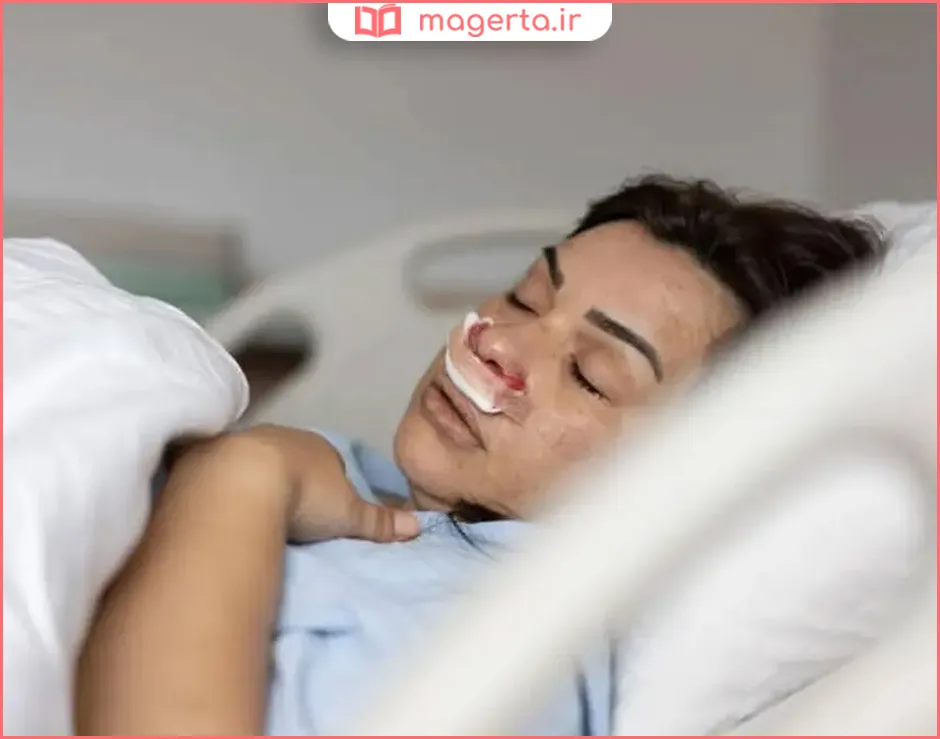 عوارض خوابیدن به پهلو بعد از بینی