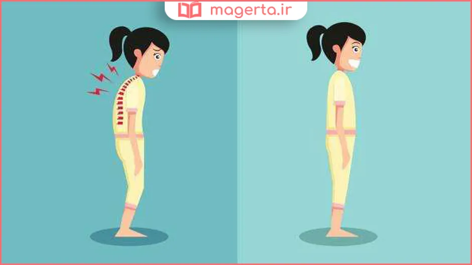 حالت صحیح ایستادن